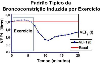Asma Brônquica/Asma de Exercício :: Dr. Pierre d'Almeida Telles Filho